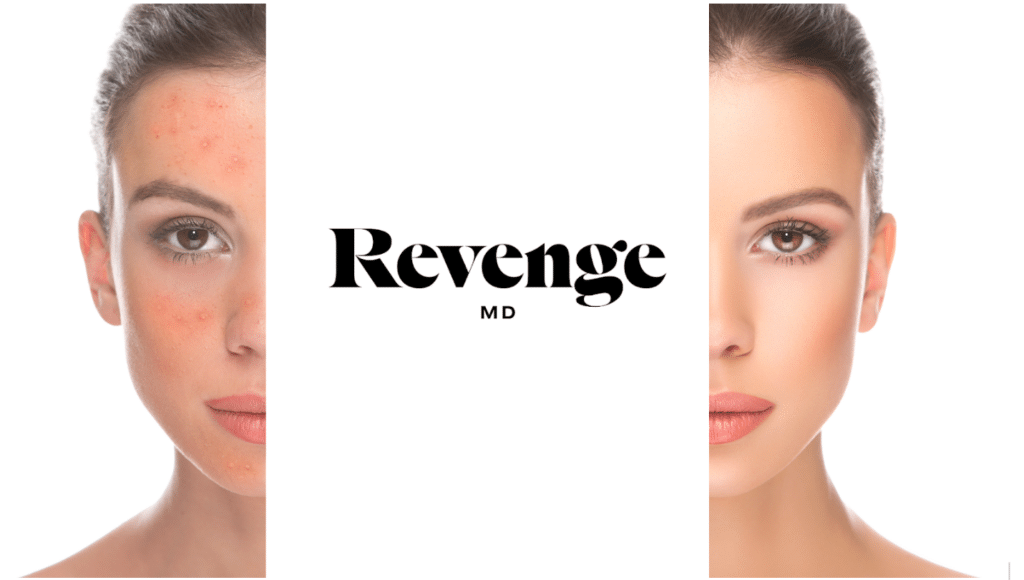 Revitalize Your Skin: What is IPL Facial Therapy? Revenge MD