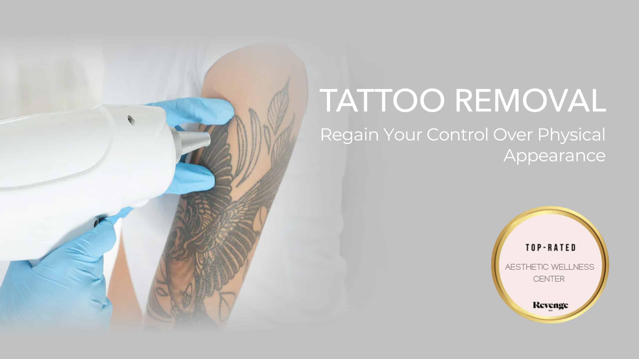 Tattoo Removal in Las Vegas & Henderson, NV