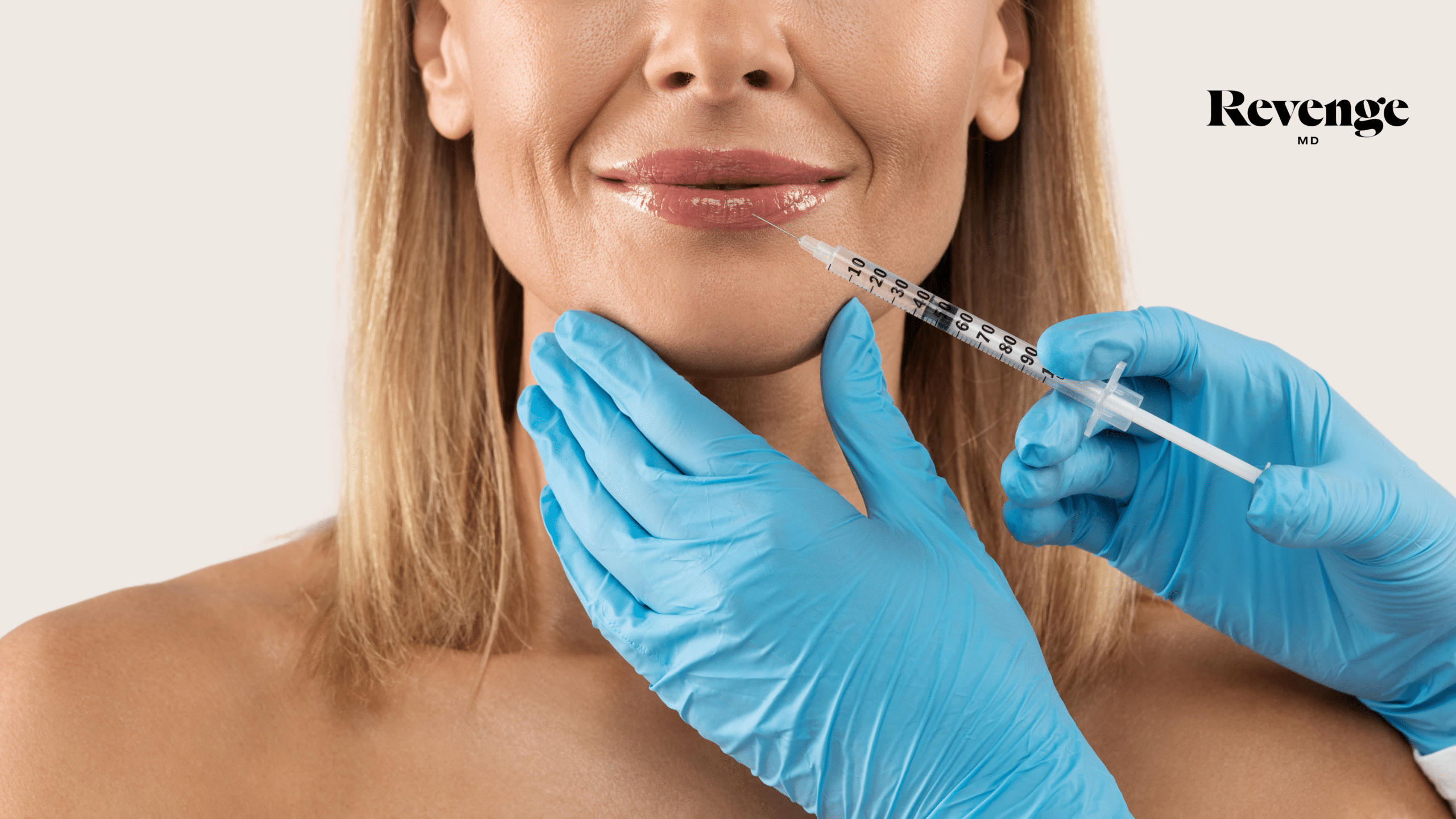 Expert Tips For Lip Filler By Revenge MD