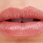 Lip Filler FAQ